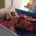 পঞ্চগড়ে জন্মগত ত্রুটির সাথে দুই মাথা নিয়ে নবজাতকের জন্ম
