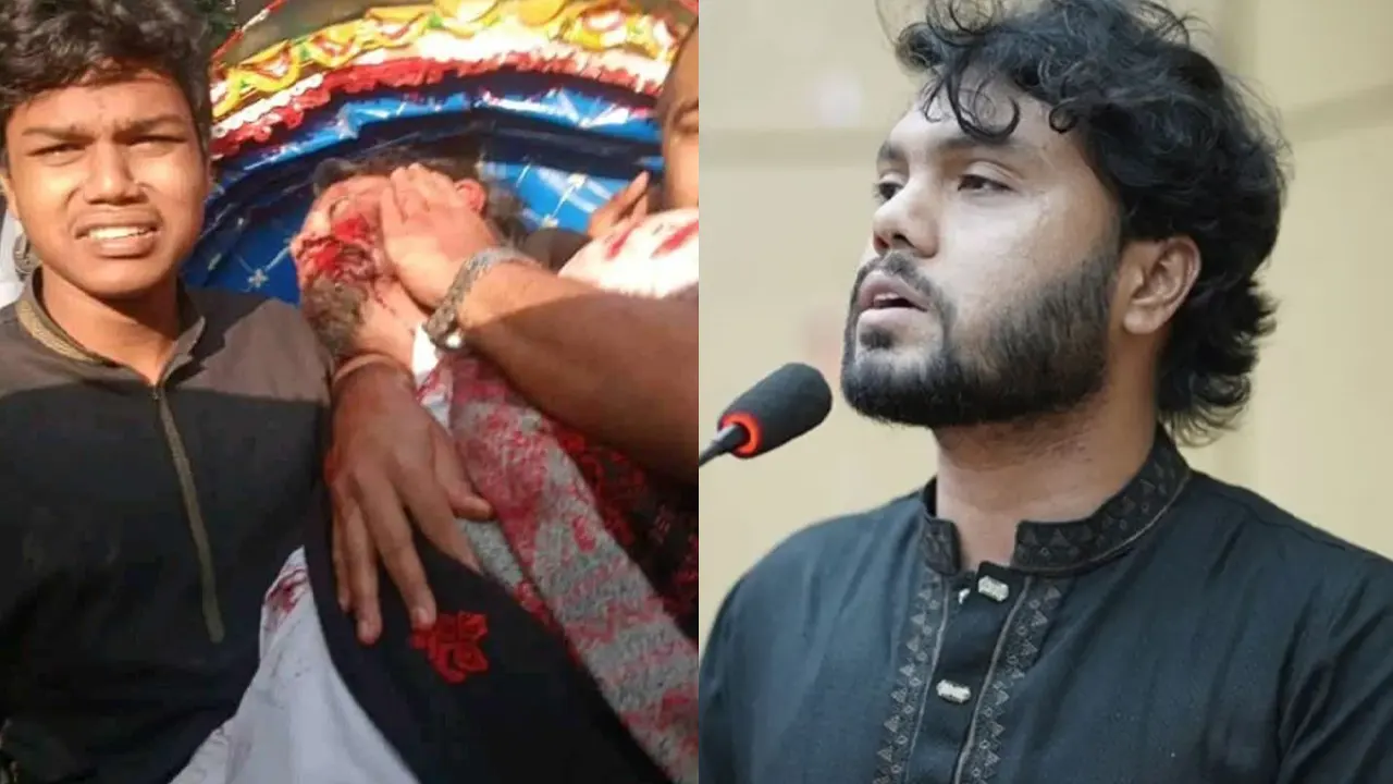 বাম কানের নিচে গুলি লেগেছে ওসমান হাদির