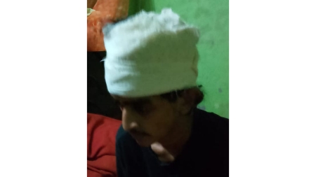 ঈদের সকালে দোকানির মারধরে রক্তাক্ত গ্রাহক, মাথায় ৭টি সেলাই!