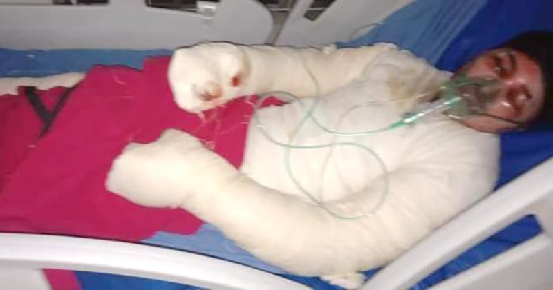 কলারোয়ায় তালাবদ্ধ ঘরে পেট্রোল ঢেলে আগুন: অগ্নিদগ্ধ কাদেরের মৃত্যু