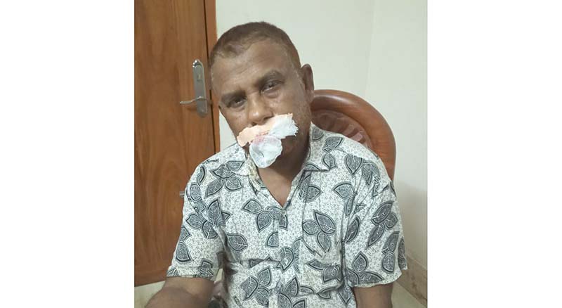 মাগুরায় প্রতিপক্ষের হামলায় আ.লীগ নেতা আহত