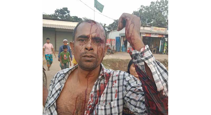 সোনারগাঁওয়ে যুবলীগ নেতাকে হত্যা চেষ্টার অভিযোগ