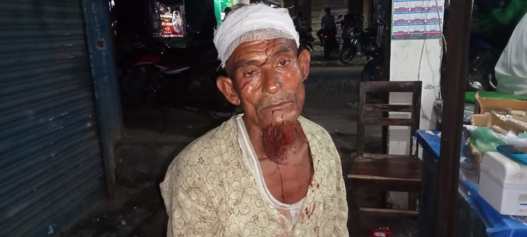 সালথায় সরকারি হালট কাটতে নিষেধের ঘটনায় বৃদ্ধকে কুপিয়ে আহত