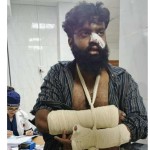 সড়ক দুর্ঘটনায় দোহারের অভিনেতা বিল্লাল মাহমুদ গুরুতর আহত