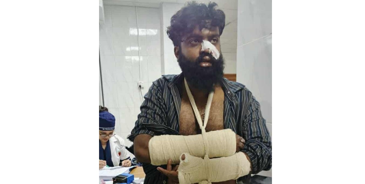 সড়ক দুর্ঘটনায় দোহারের অভিনেতা বিল্লাল মাহমুদ গুরুতর আহত