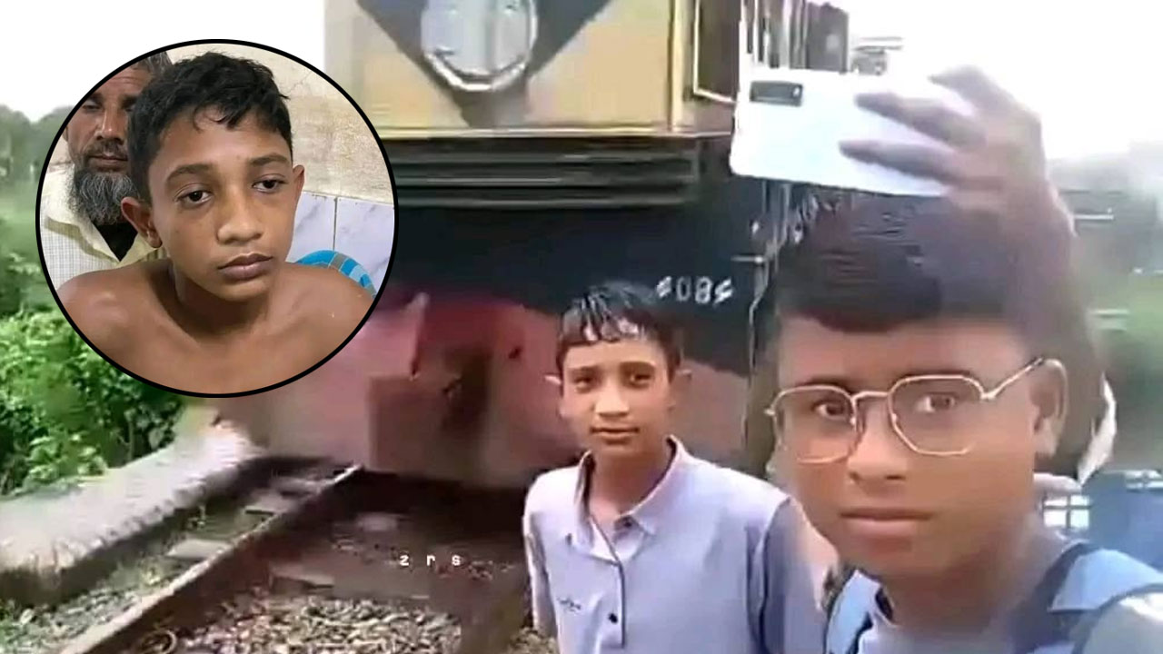 সেলফি তুলতে গিয়ে ট্রেনের ধাক্কা, অলৌকিকভাবে সেই কিশোর এখন সুস্থ