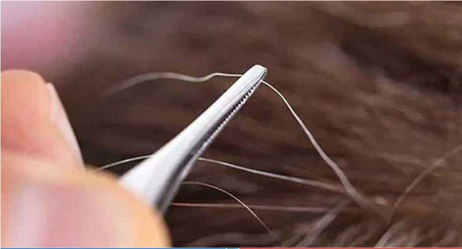 পাকা চুলের সঙ্গে ক্যানসারের সম্পর্ক নিয়ে নতুন তথ্য