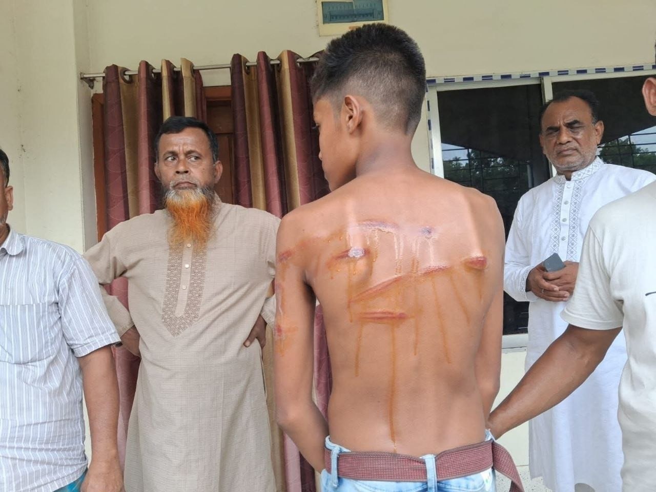 রাজবাড়ীর পাংশায় শিক্ষকের বেত্রাঘাতে হাসপাতালে ছাত্র, অবরুদ্ধ শিক্ষক